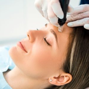 Rejuvenate Your Skin With MNRF Treatment in Bangalore