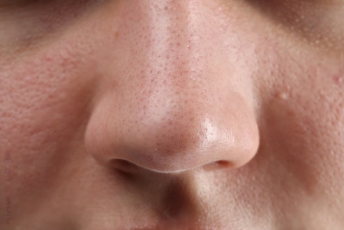 Women Face after Photo Facial Treatment