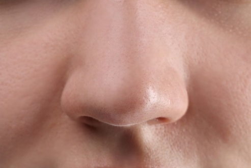 Women Face after Photo Facial Treatment