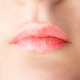 Women Face Filler after Treatment