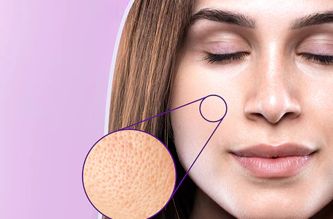 Top Open Pores Treatments in Bangalore – Dr. Ruby Sachdev