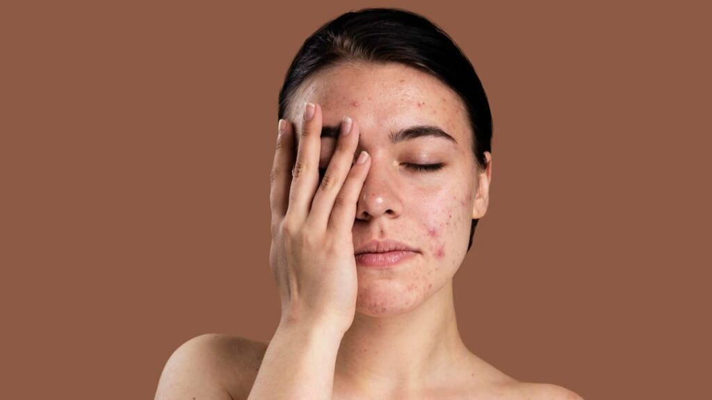What Causes Sensitive Skin & How to Manage It | Dr. Ruby Sachdev