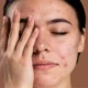 next thumbnail
